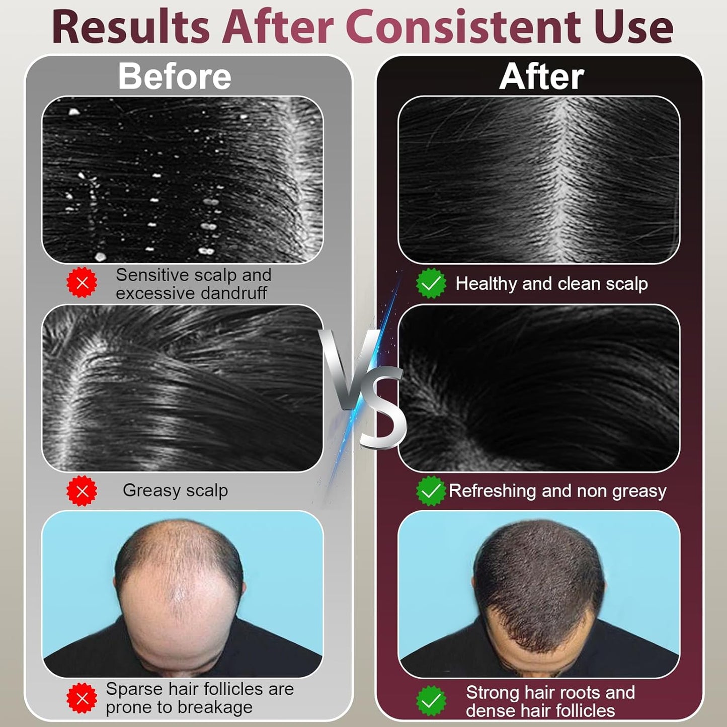 VitaScalp™ Electric Scalp Massager & Oil Applicator