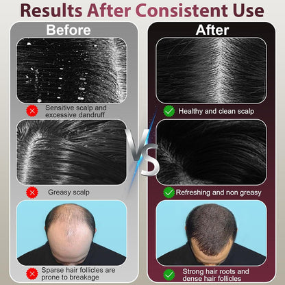 VitaScalp™ Electric Scalp Massager & Oil Applicator